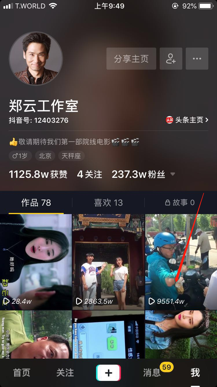 抖音赞10000只需一毛（抖音10000赞可以换多少钱）