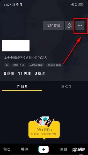 抖音1元100赞（点赞自助业务下单平台）